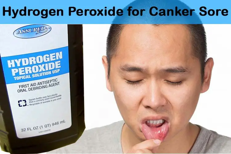 What are some good mouthwashes for canker sores?