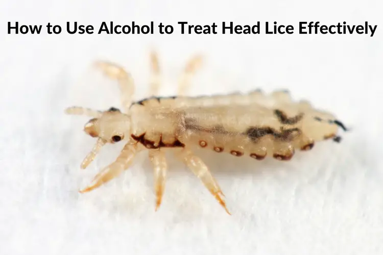 Will rubbing alcohol kill lice?