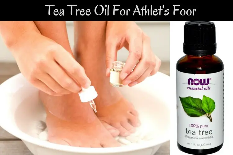 Tea Tree Oil Athletes Foot 85